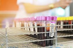 Forensic Toxicology